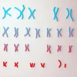 What is Down syndrome?